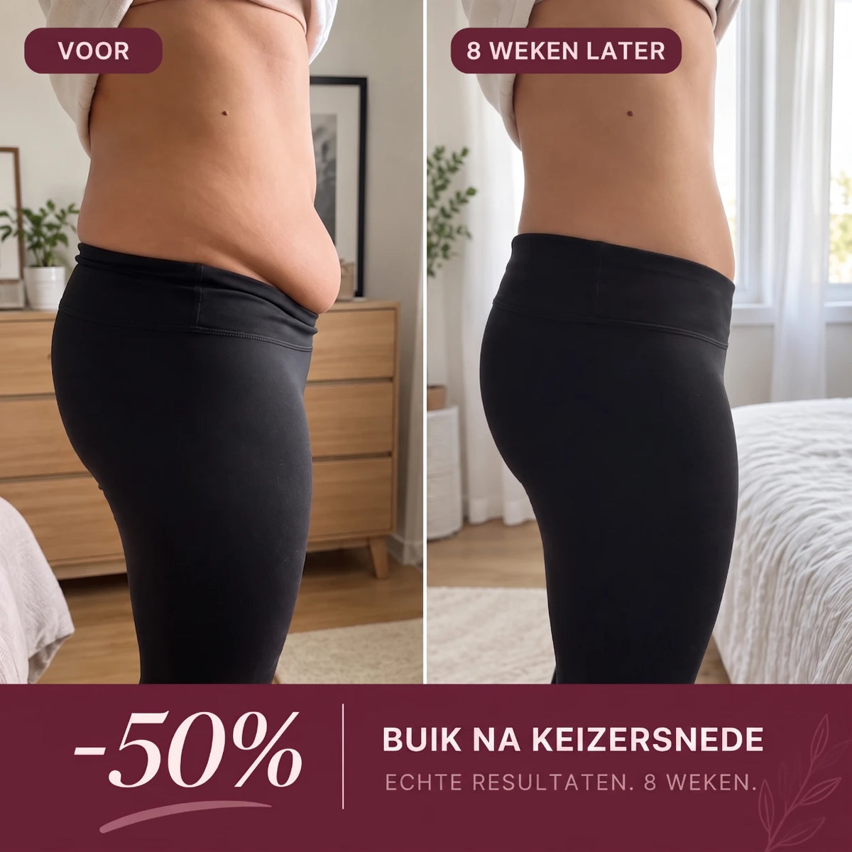 FormFlex™ Corrigerende Slip